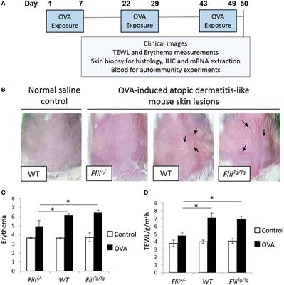 Flightless I Alters the Inflammatory Response and Autoantibody Profile in an OVA-Induced Atopic Dermatitis Skin-Like Disease